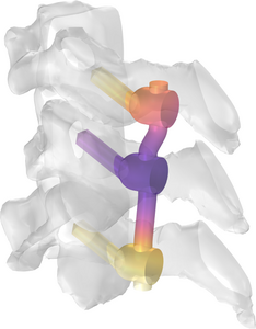 MRI 中的射频植入物加热