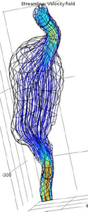 Hemodynamic Simulations of ...