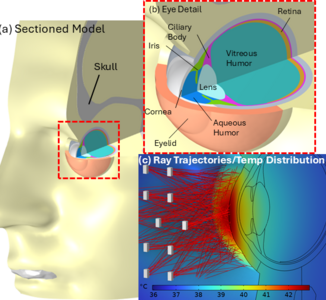 Multiphysics thermal ...