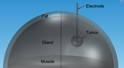 Modeling Radiofrequency ...
